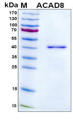 Human ACAD8 Protein (Recombinant 6His, N-terminus)