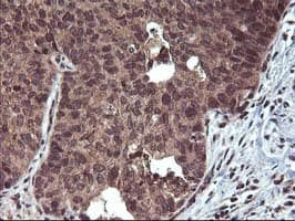 FGF21 Antibody (clone OTI2F10)