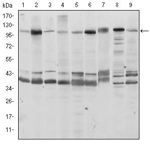 FKTN / Fukutin Antibody (clone 600)