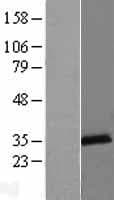 LACTB2 Protein (Over-Expression Lysate Myc-DDK (Flag))