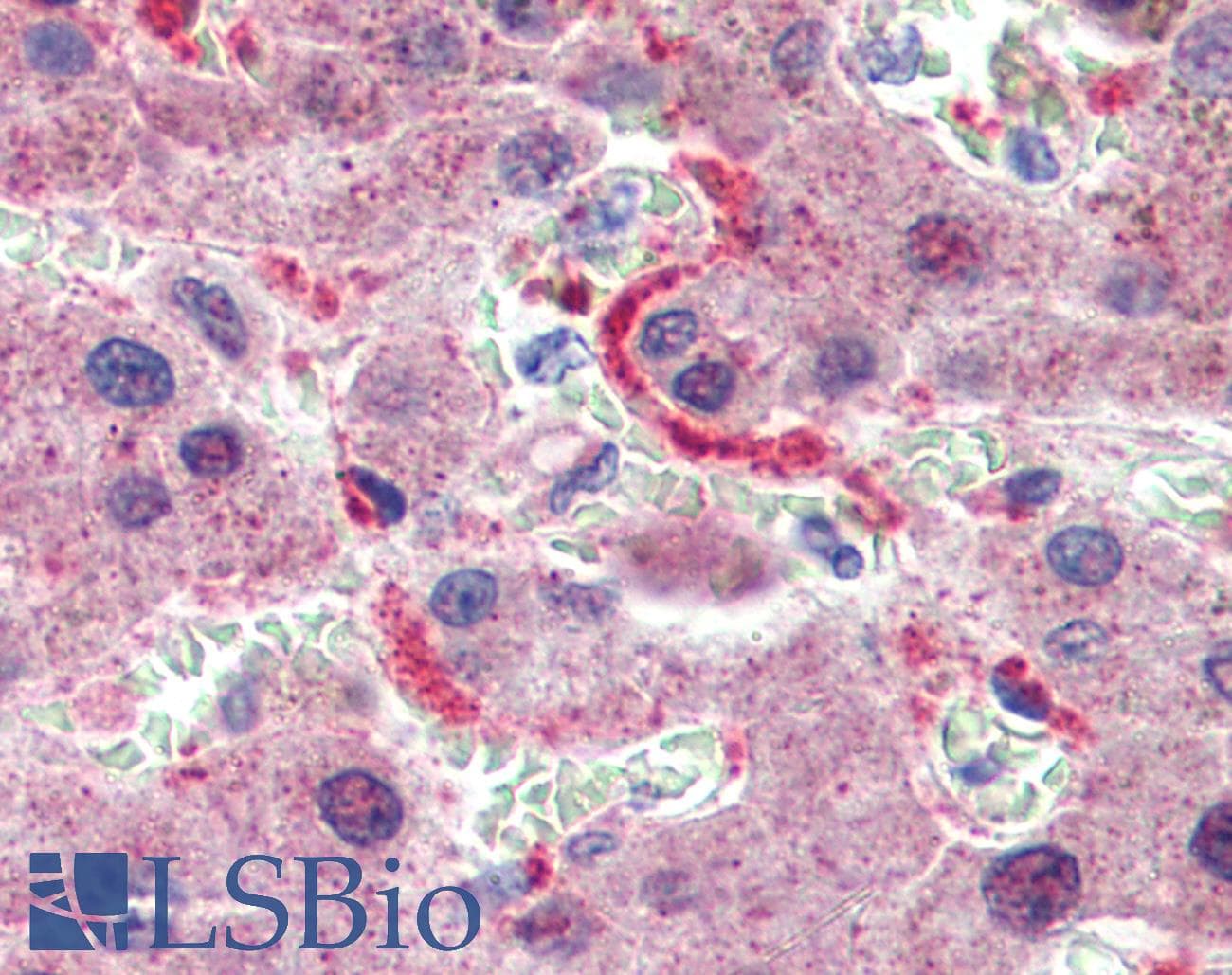GPSM2 / LGN Antibody (aa72-121)