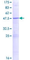 Human ZNF614 Protein (Recombinant GST)