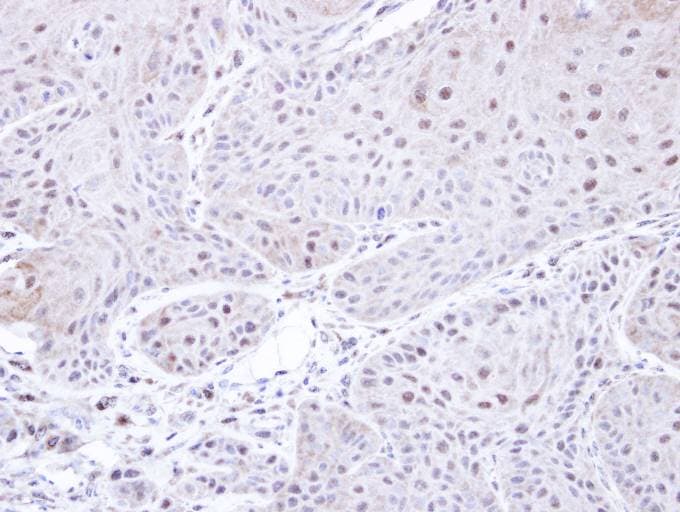PSMC3 Antibody (aa51-361)