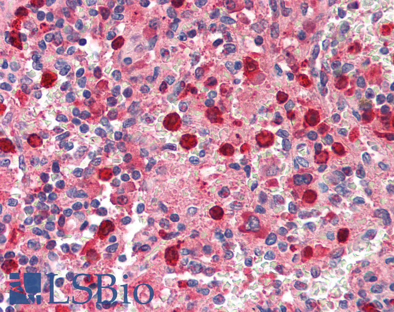 IHC-plus™ MPO / Myeloperoxidase Antibody