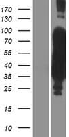Human MAPT / Tau Protein (Over-Expression Lysate Myc-DDK (Flag))