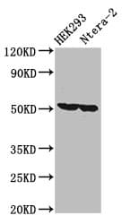 Polyclonal Rabbit anti-Human TIP49 / RUVBL1 Antibody