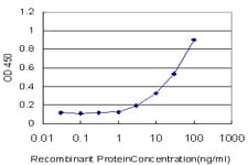 CHEK1 / CHK1 Antibody (clone 2G3)