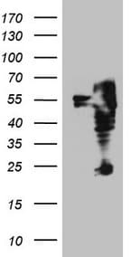 Monoclonal Mouse anti-Human ITPK1 Antibody (clone OTI1F5, aa309-391, IHC, WB)