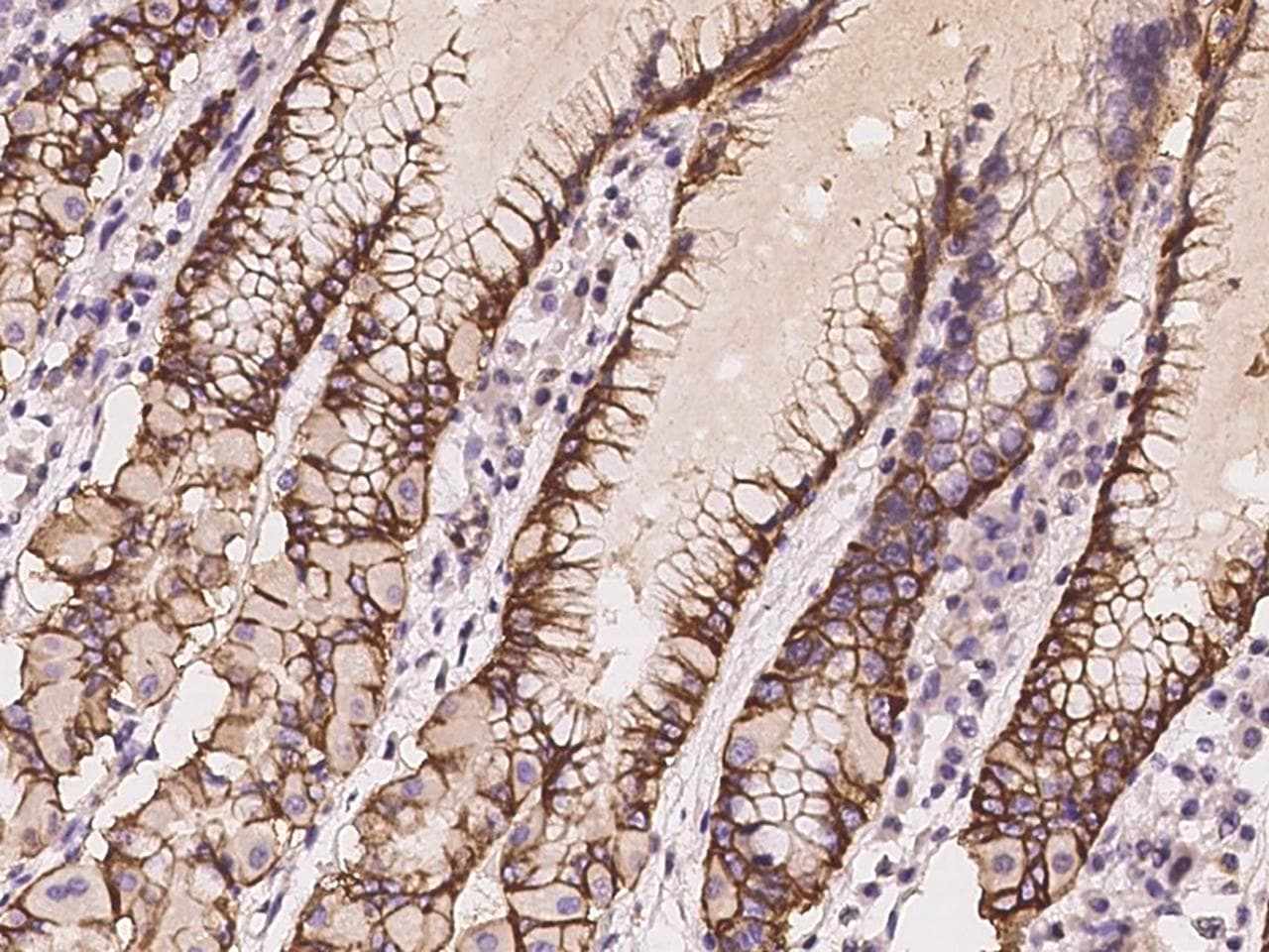 SLC9A1 / NHE1 Antibody