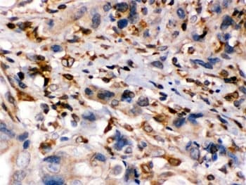 Polyclonal Rabbit anti-Human ABCB2 / TAP1 Antibody (IHC, WB)