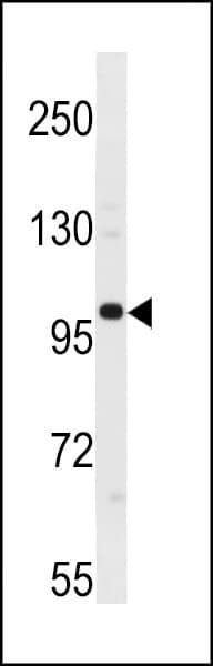 IHC-plus™ Polyclonal Rabbit anti-Human ESCO1 / ECO1 Antibody (aa661-687, IHC, WB)