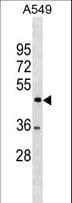 Polyclonal Rabbit anti-Human TSPYL1 Antibody (aa343-372, WB)