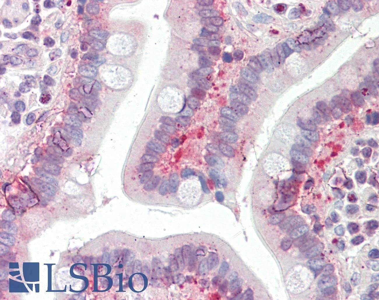 IHC-plus™ SLC25A19 Antibody (aa236-263)