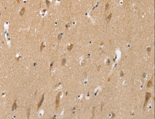 SLC6A7 Antibody