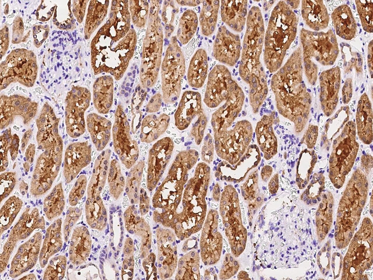 Polyclonal Rabbit anti-Human IGFBP6 Antibody (IHC)