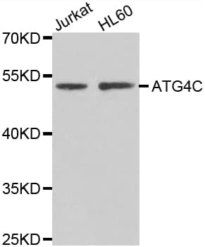 Polyclonal Rabbit anti-Human AUTL1 / ATG4C Antibody (IHC, WB)