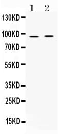Polyclonal Rabbit anti-Human AKAP2 Antibody (WB)