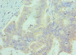 CCL28 / MEC Antibody (aa20-127)