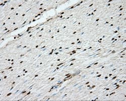 ERCC1 Antibody (clone OTI1G6)