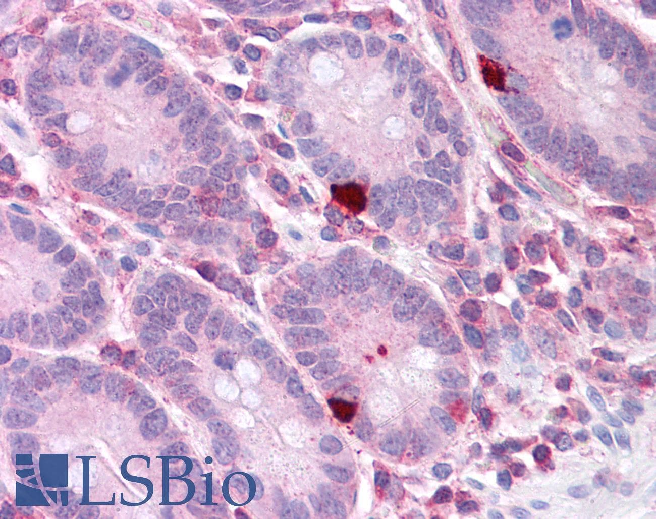Polyclonal Rabbit anti-Human EEF2 / Elongation Factor 2 Antibody (aa36-85, IHC, WB)