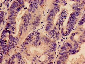 Polyclonal Rabbit anti-Human PREX1 / P-REX1 Antibody (IHC, IF)