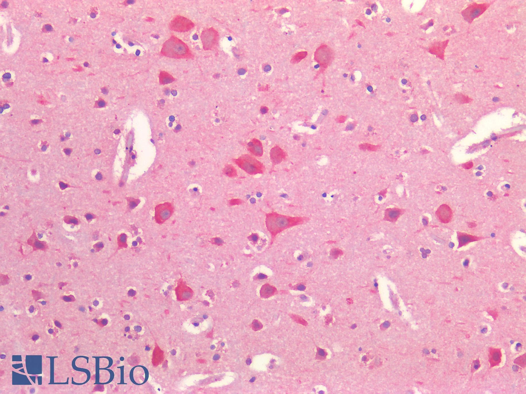 IHC-plus™ Polyclonal Rabbit anti-Human P2RX3 / P2X3 Antibody (IHC)