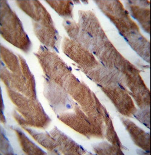 Polyclonal Rabbit anti-Human MATN1 / Matrilin 1 Antibody (aa376-405, IHC, WB)