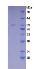 Human Beta-N-Acetylglucosaminidase Protein (Recombinant His)