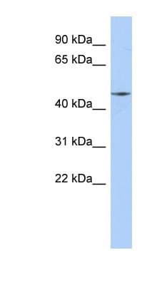 RIMKLA Antibody (aa143-192)