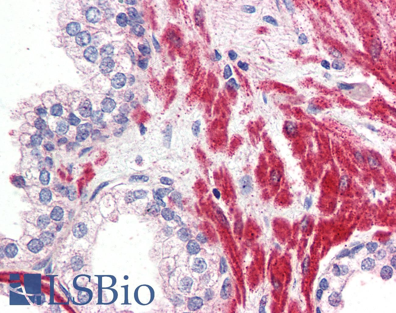 IHC-plus™ OR51E1 Antibody (Internal)