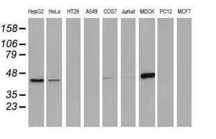 IHC-plus™ CTH / Cystathionase Antibody (clone 2D6)