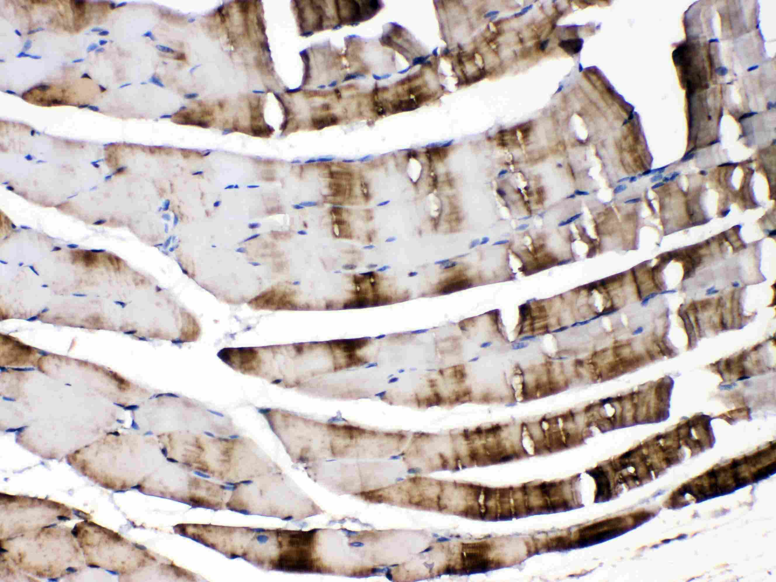 Polyclonal Rabbit anti-Human CA3 / Carbonic Anhydrase III Antibody (IHC, WB)