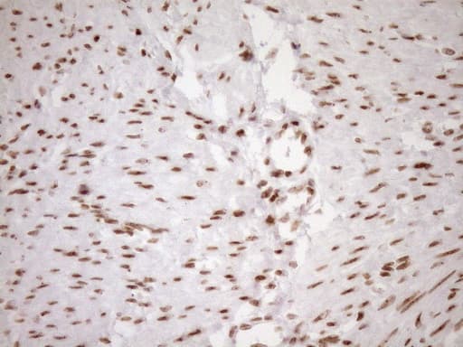 EXOSC1 / CSL4 Antibody (clone OTI1H9)