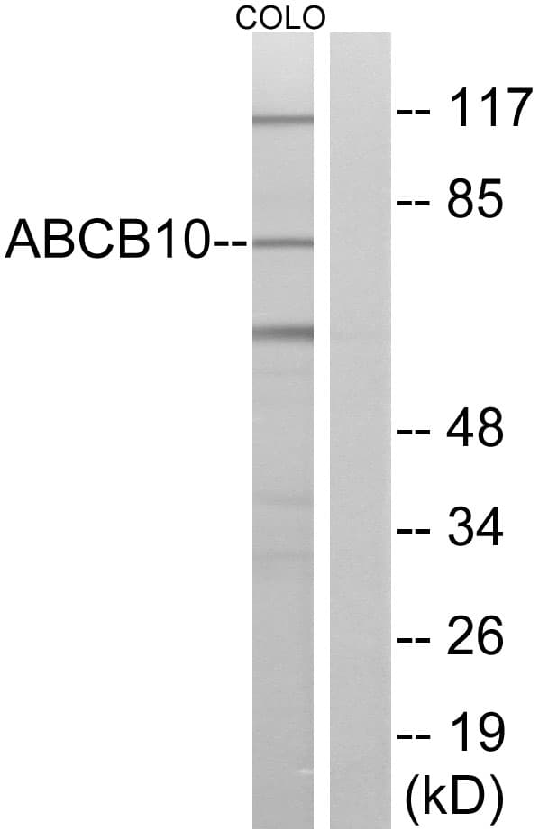 IHC-plus™ ABCB10 Antibody (aa441-490)