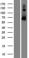 CCDC102B Protein (Over-Expression Lysate Myc-DDK (Flag))