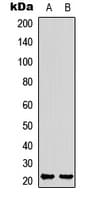 IHC-plus™ STMN4 / RB3 Antibody (C-Terminus)