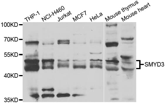 SMYD3 Antibody