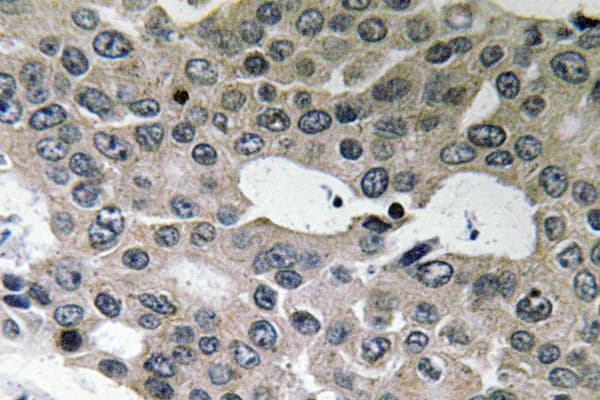 BNIP2 Antibody (aa73-122)