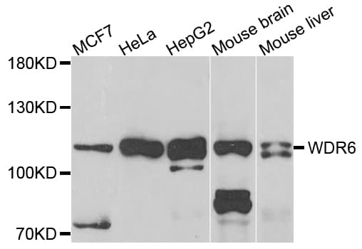WDR6 Antibody