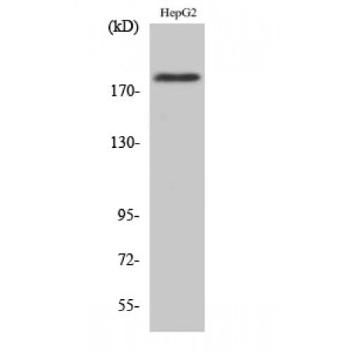 IRS1 Antibody (1040-1120 aa)