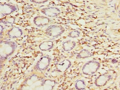 OTUD6B Antibody