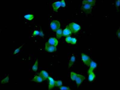 Polyclonal Rabbit anti-Human CDAN1 Antibody (IHC, IF)