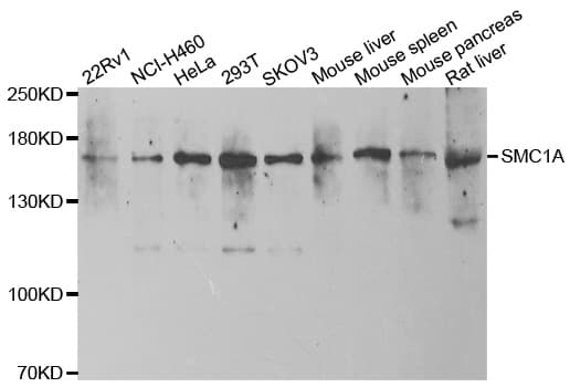 SMC1A / SMC1 Antibody