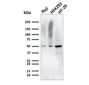 Monoclonal Mouse anti-Human MMP3 Antibody (clone MMP3/2655, Ready-to-Use, IHC)
