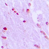 AIFM1 / AIF / PDCD8 Antibody (N-Terminus)