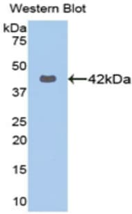 KRT16 / CK16 / Cytokeratin 16 Antibody (aa117-419)