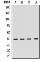 ARHGAP1 / CDC42GAP Antibody
