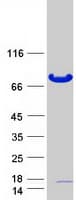 Human OGFOD1 Protein (Recombinant Myc-DDK (Flag))