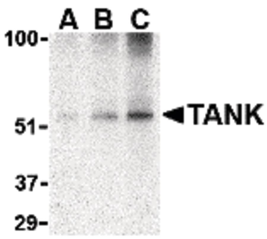 IHC-plus™ Polyclonal Rabbit anti-Human TANK Antibody (IHC, IF, WB)