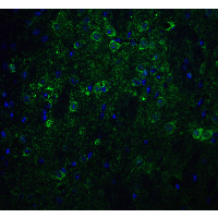IHC-plus™ NCSTN / Nicastrin Antibody